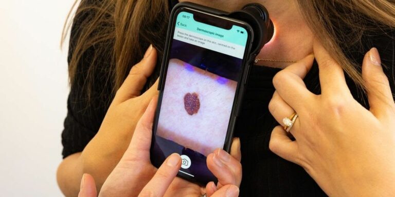 NICE recommends first autonomous AI medical device to support skin ...